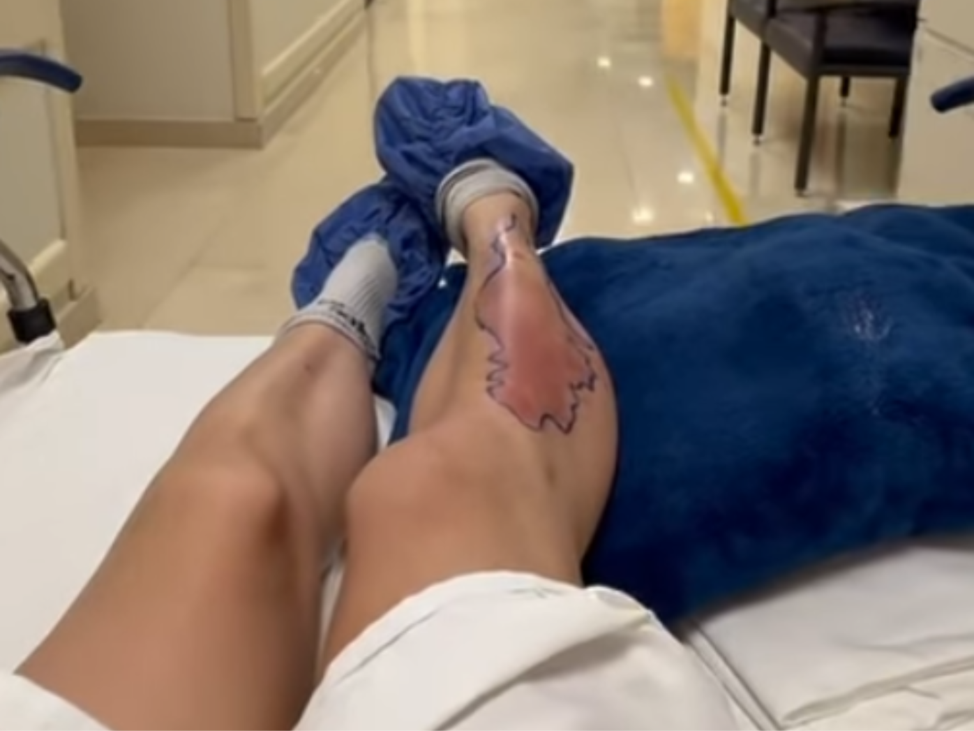 Taylor Momsen bitten by spider during AC/DC tour in Mexico