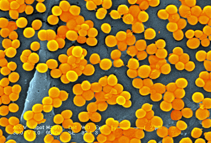 Methicillin Resistant Golden Staph Staphylococcus Aureus Mrsa