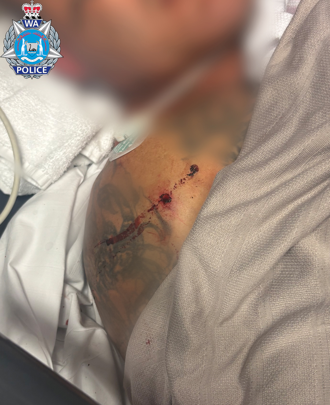 WA Police released some images showing the extent of the man's injuries.