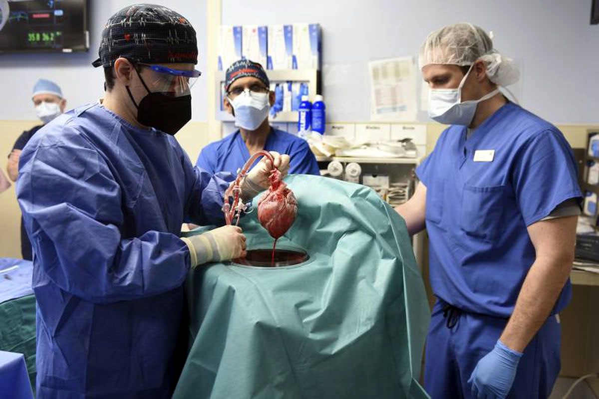 Members of the surgical team show the pig heart for transplant, after a world-first operation in January.