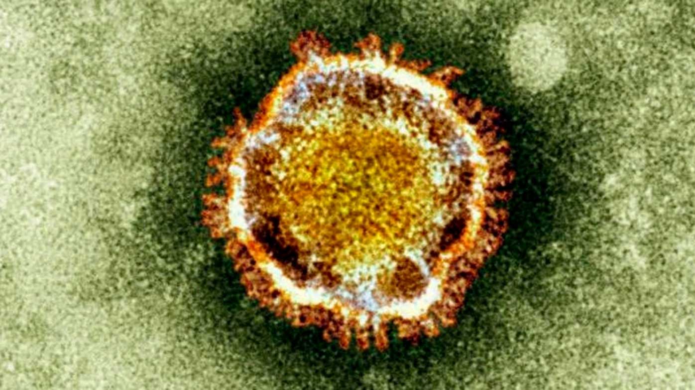 The coronavirus as seen under a microscope.