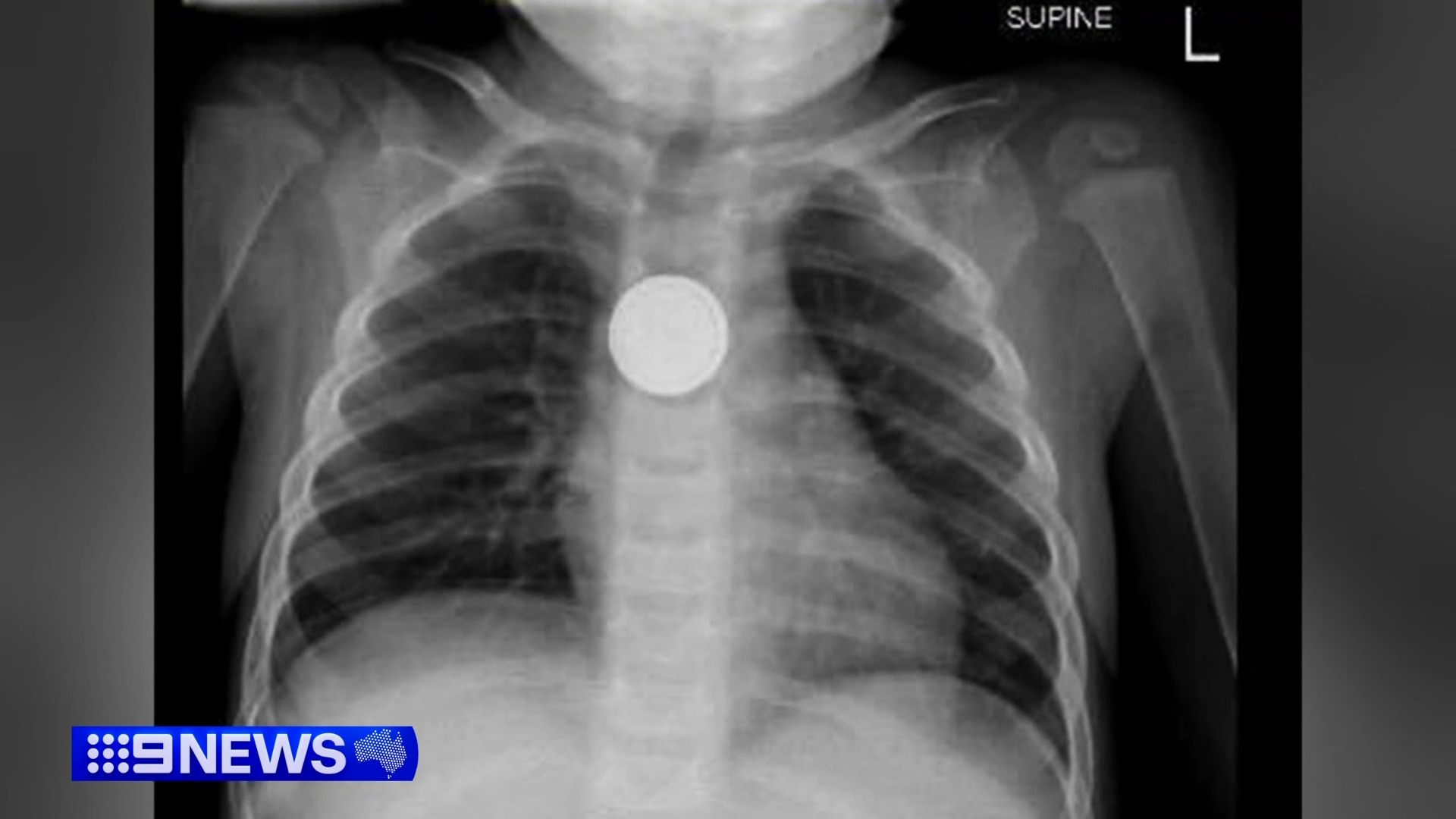 Urgent health warning to parents over potentially deadly everyday item