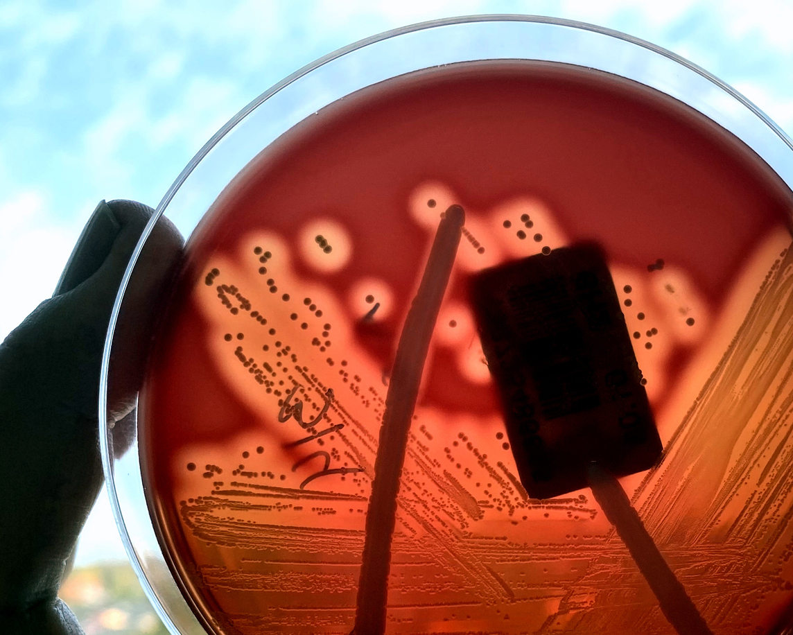 An estimated 700 million GAS infections occur worldwide each year, over 650,000 of the cases are severe and invasive, and have a mortality rate of 25%. GAS is also called the flesh-eating-bacteria.