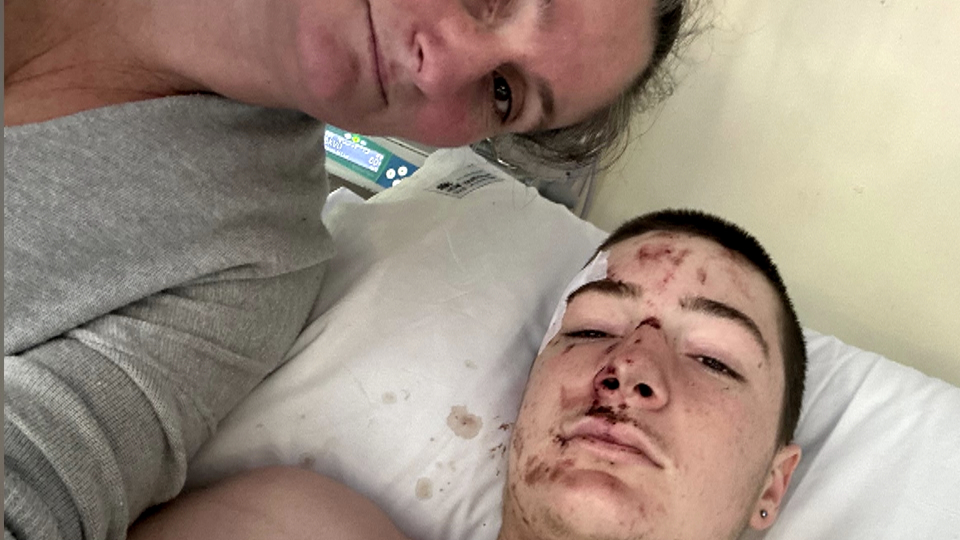 Aiyden O'Donoghue, now 16, was nearly killed after hanging off a train as part of a social media trend called 'buffer riding' last year.﻿O'Donoghue had broken into the back carriage of a train as it passed Bankstown Station to participate in the trend, which consists of hanging from the back of a moving train.