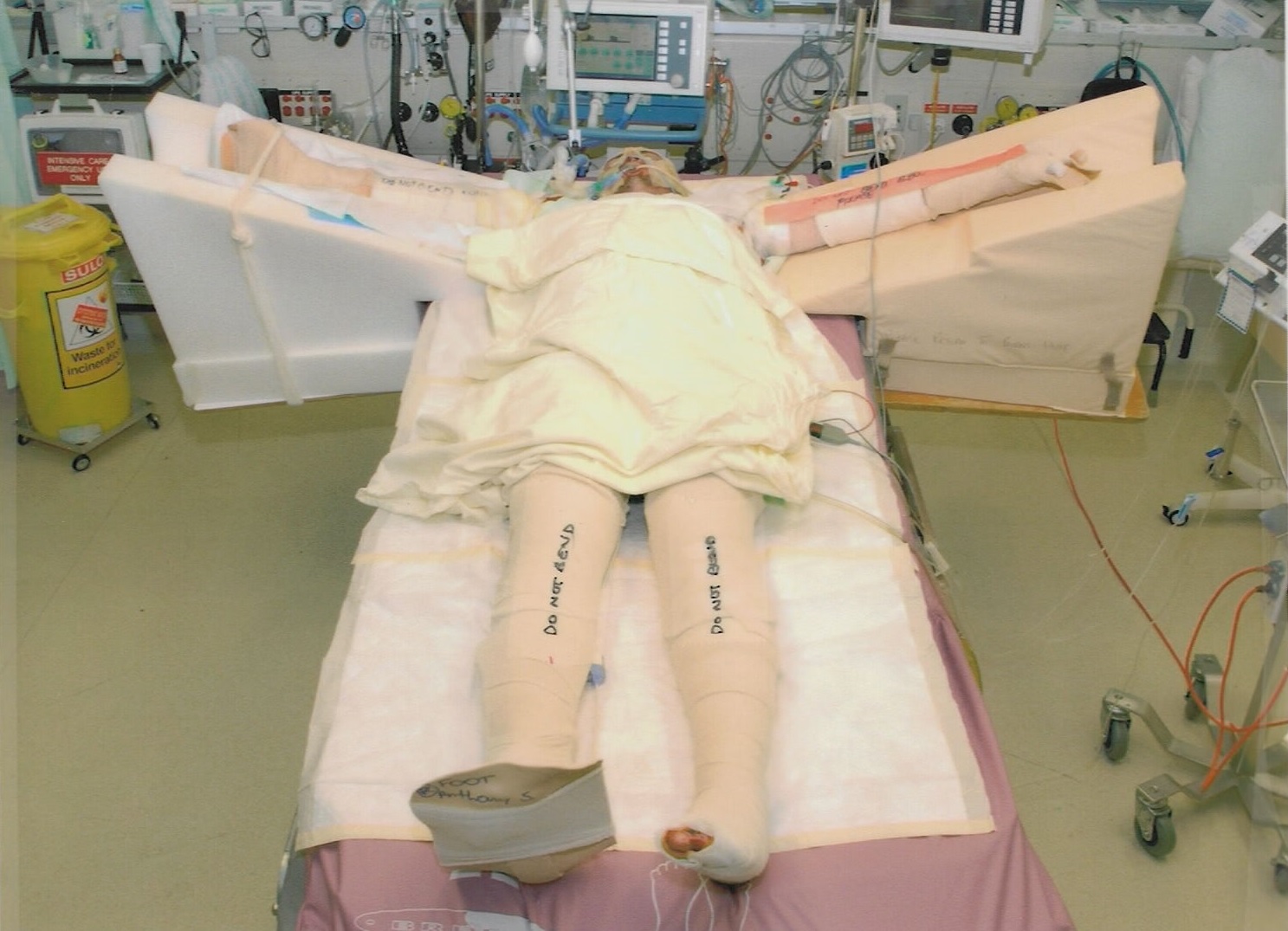Svilicich was in a coma for 44 days. By the time he woke up it was the end of November.