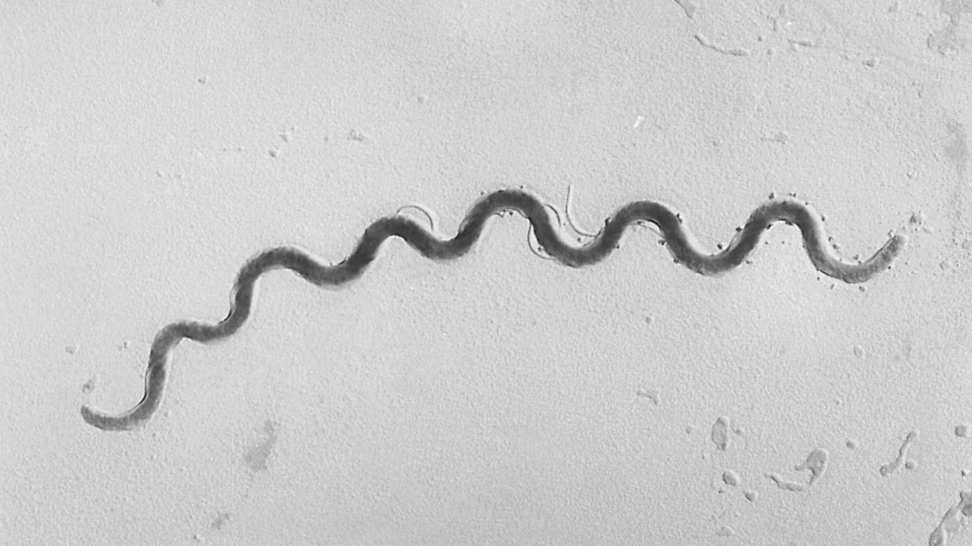 Microscope image shows a Treponema pallidum bacterium which causes the disease syphilis