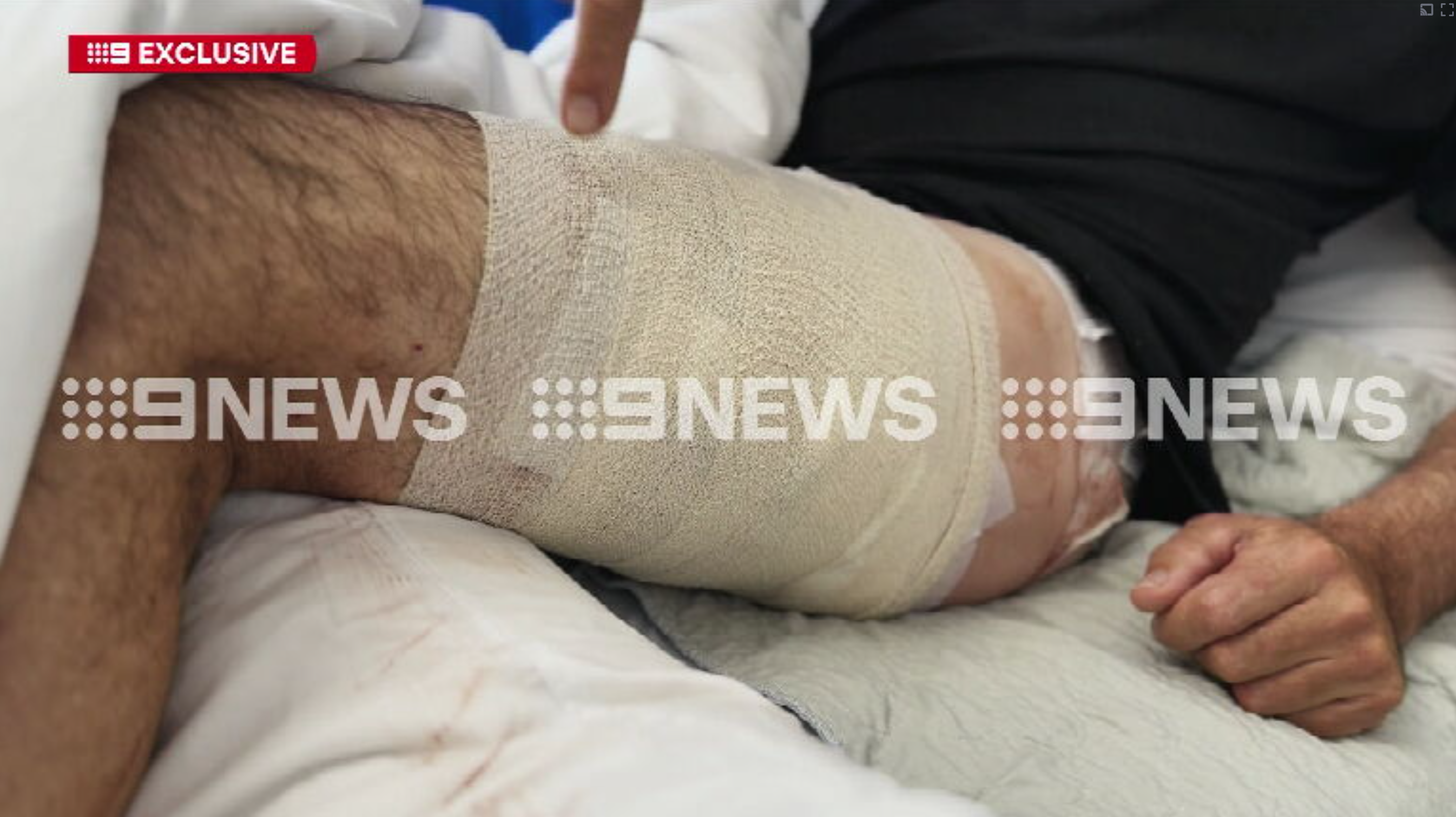 Lee Berryman Kangaroo Island Shark attack