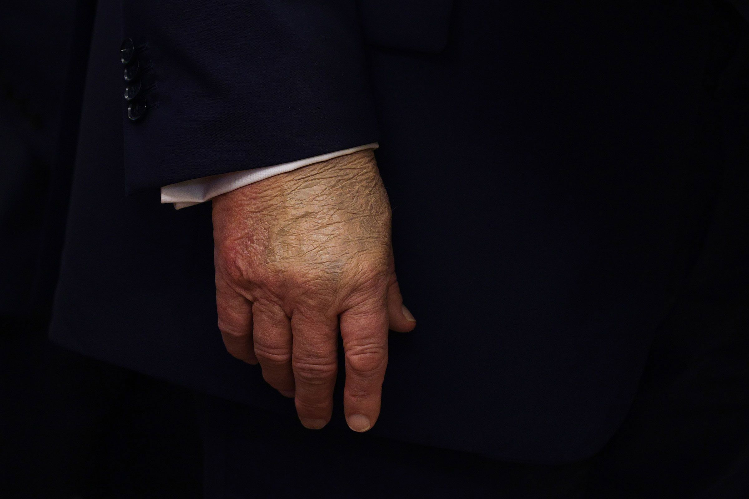 A detailed view of President Donald Trump's hand as he speaks in the Oval Office at the White House on Tuesday.