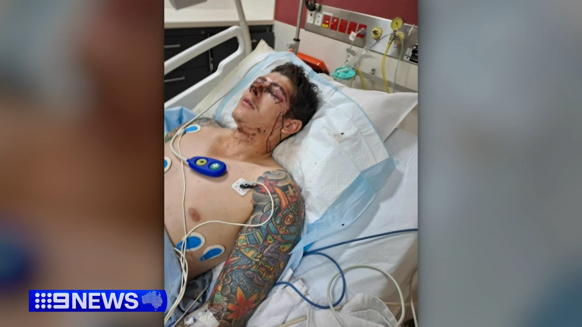 Emergency services arrived a short time later and took the 25-year-old man to hospital with non-life-threatening injuries.