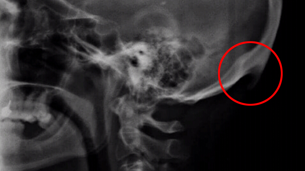 Health news Australia ‘Young Australians’ excessive mobile phone use