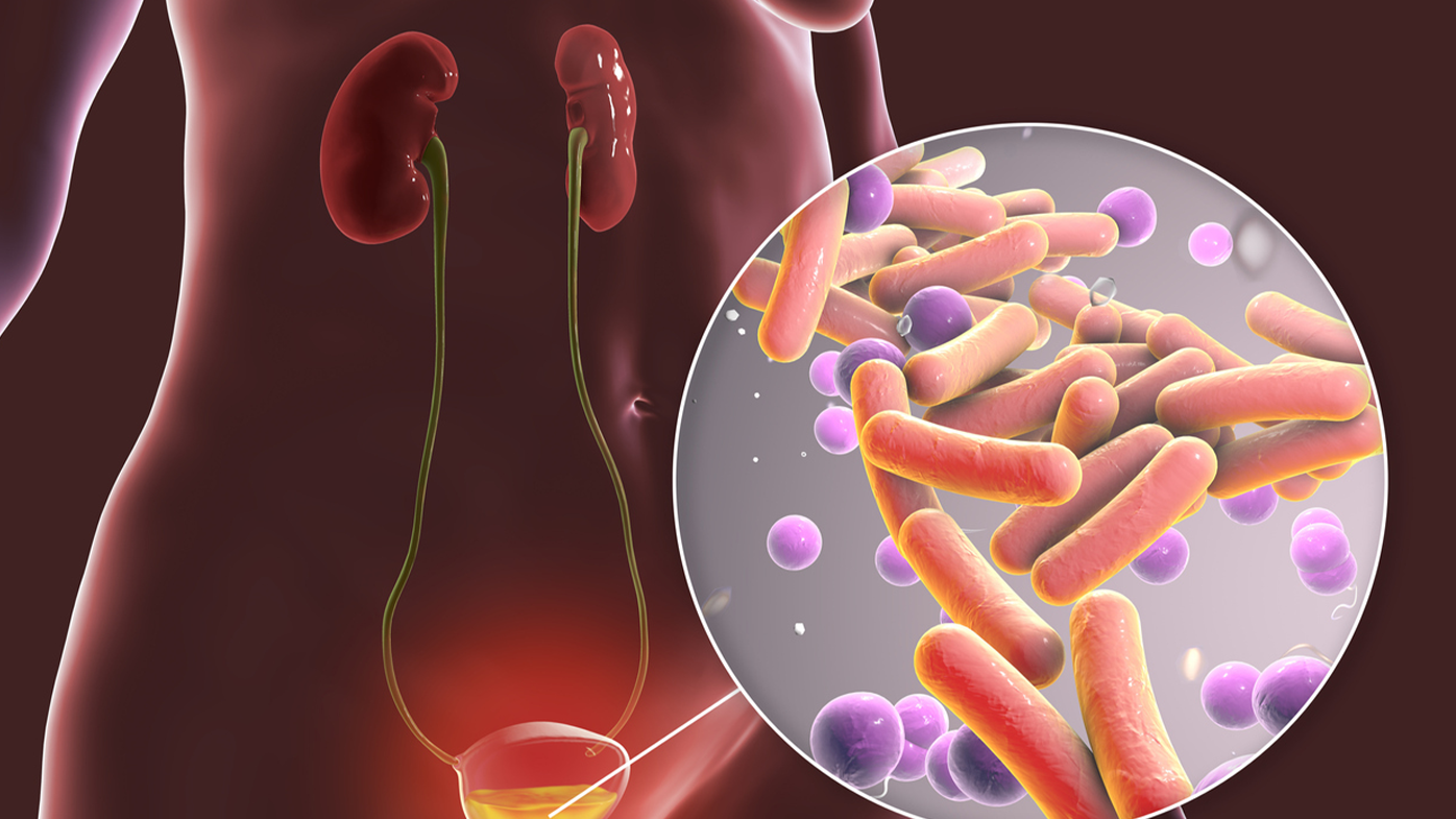 Urinary tract infections are very common, and treatment with antibiotics are often needed.