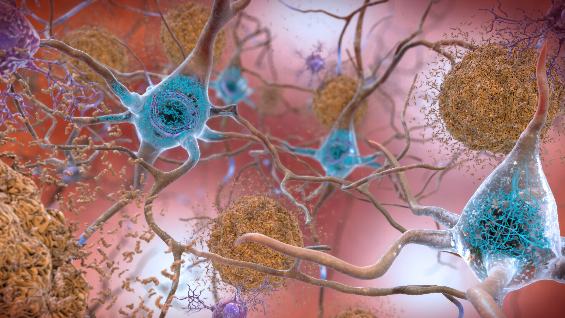 Alzheimer's disease, Alzheimer's disease generic, Alzheimer's generic