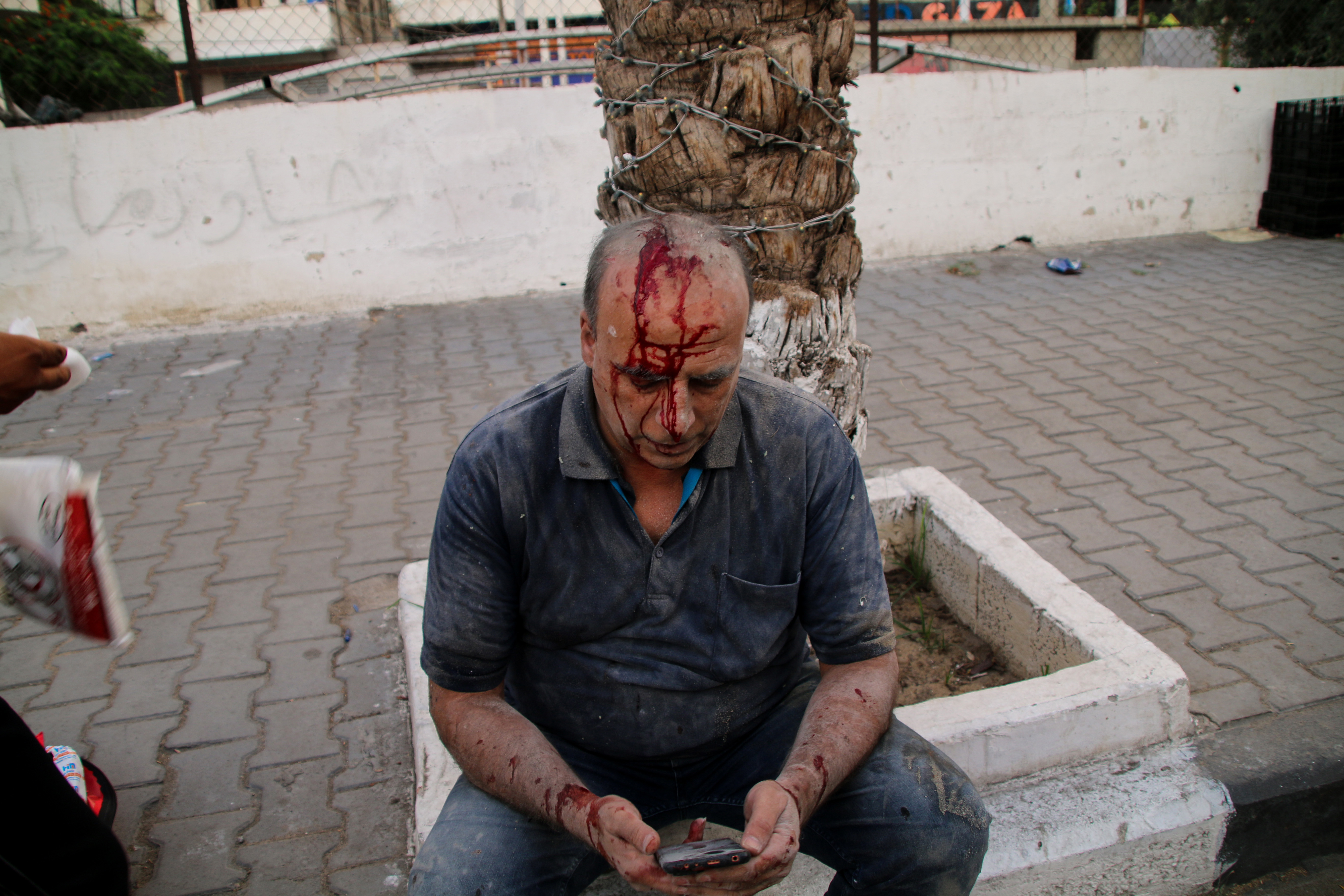 An injured man as a result of Israeli airstrikes