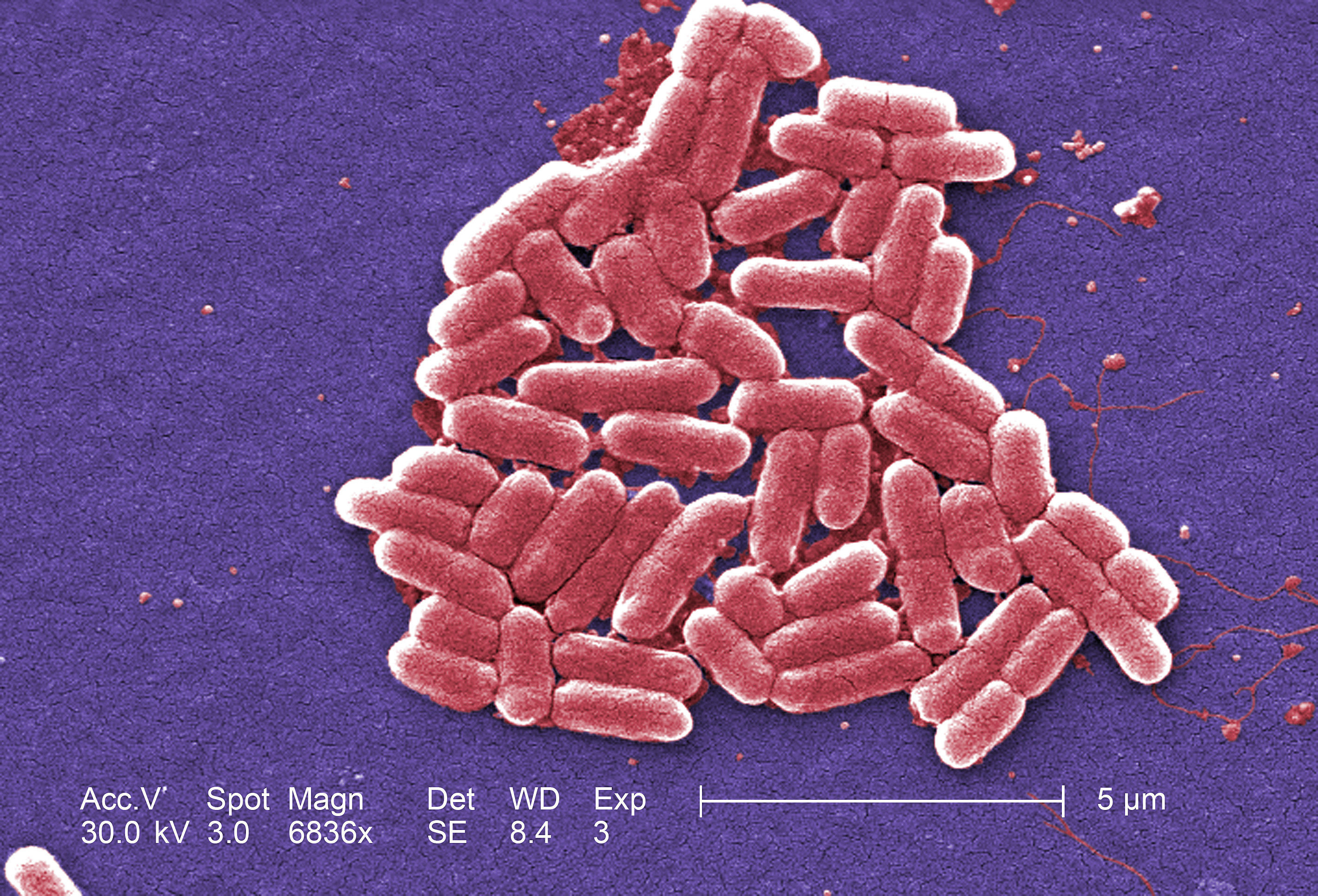 Si alguien ingiere alimentos contaminados con E. coli, puede enfermarse gravemente.