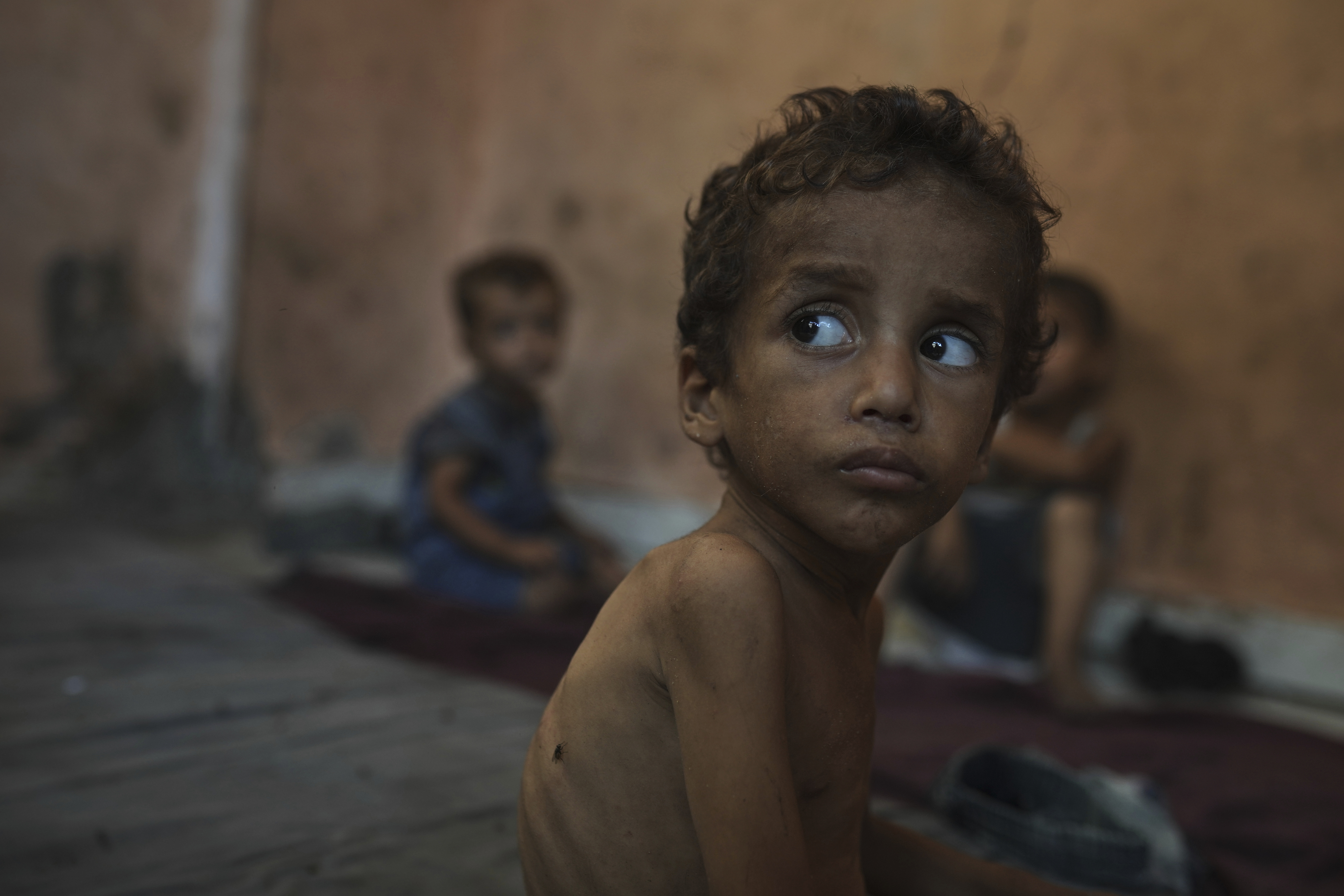 Yazan Abu Ful, a 2-year-old malnourished child, sits at his family home in the Shati refugee camp in Gaza City on Wednesday, July 23, 2025. (AP Photo/Jehad Alshrafi)