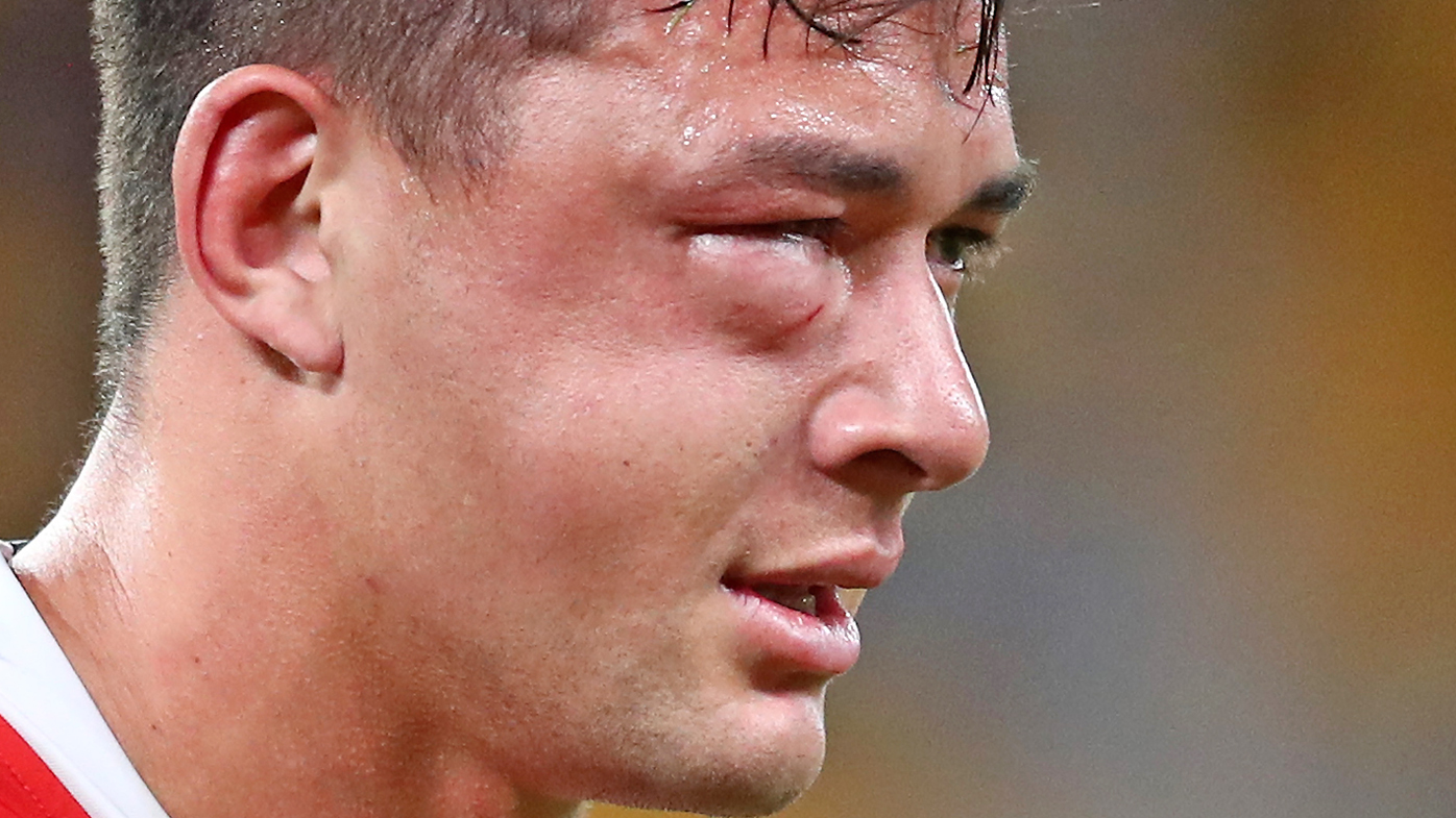 Joseph Manu sports a shocking injury from a high tackle by Latrell Mitchell