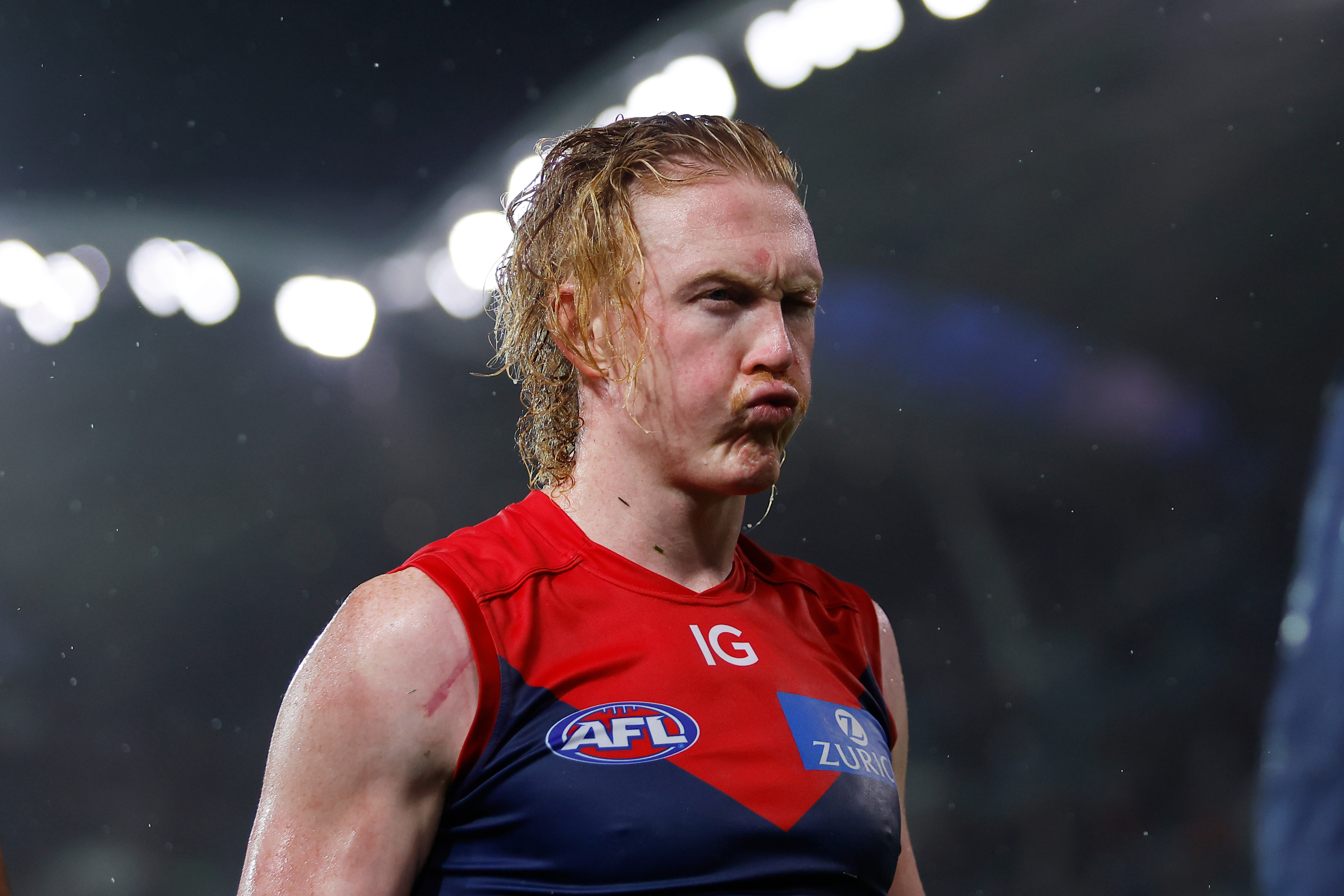 AFL news 2023: Clayton Oliver hamstring injury, Melbourne star to