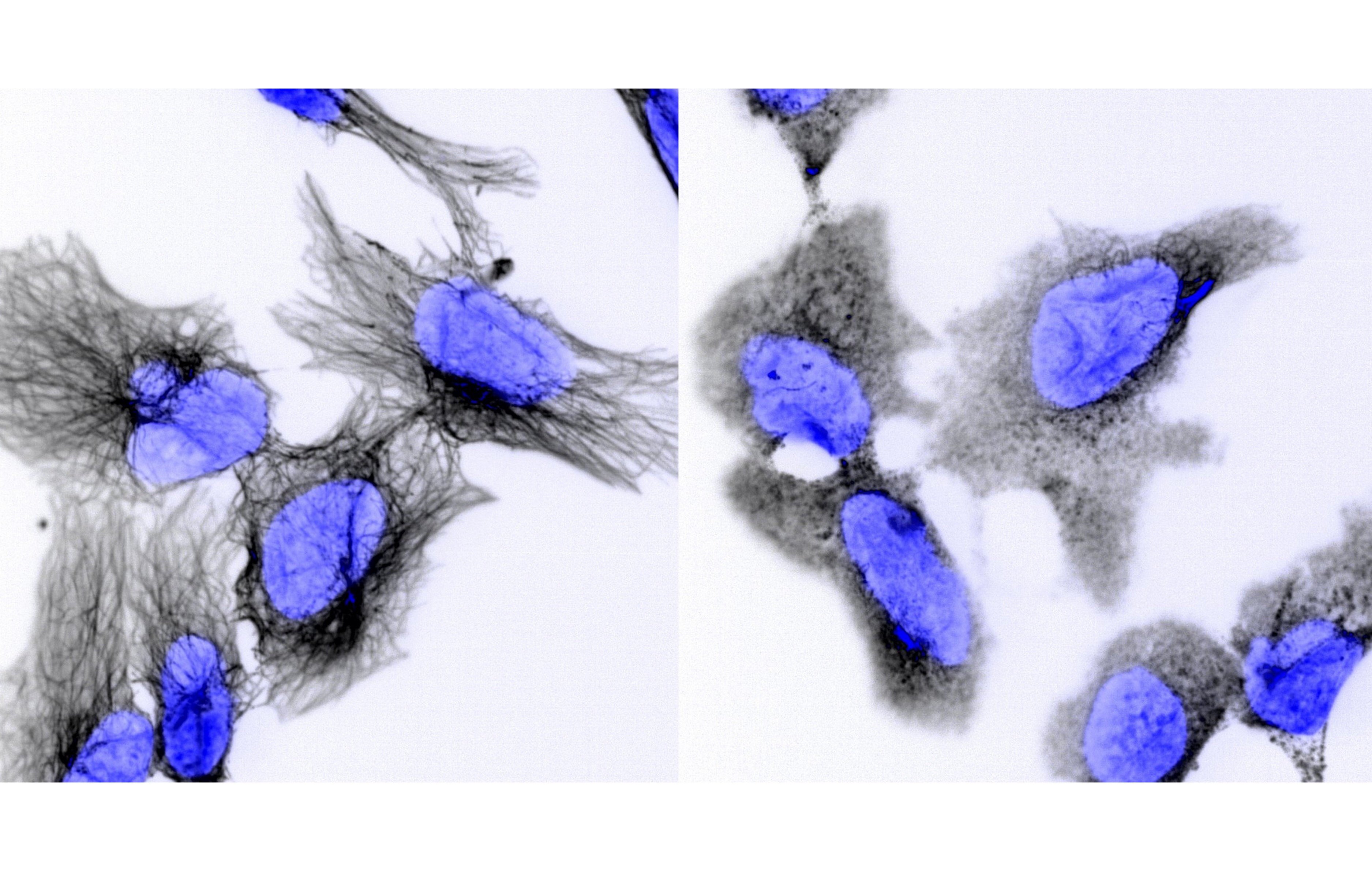 Neuroblastoma is a deadly cancer that can affect children as young as two-years-old. A new study by the Garvan Institute may have found a drug that can help cure it.