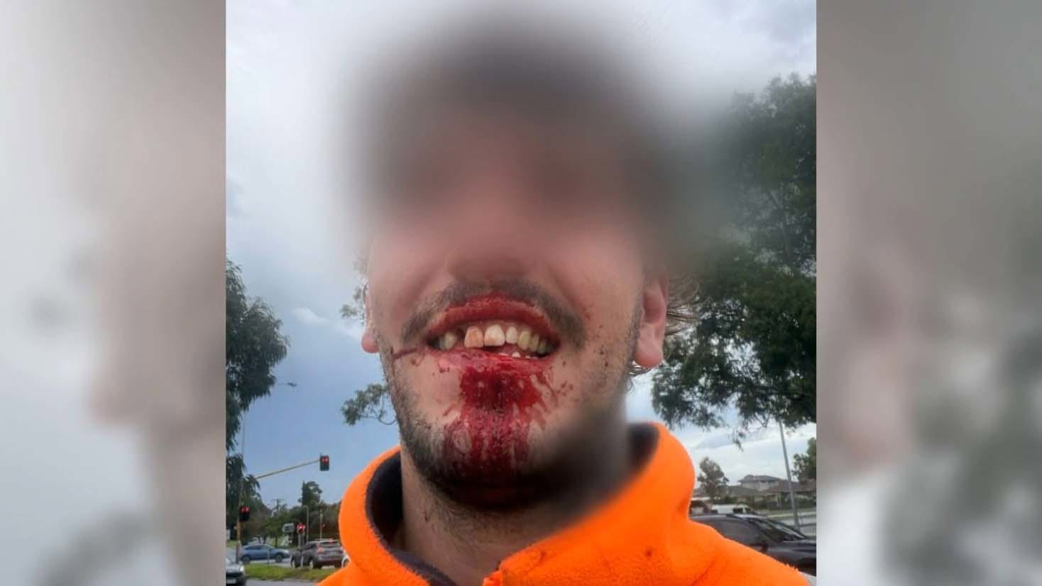 A tradie has recounted the moment he was brutally assaulted after an argument with another driver escalated. 