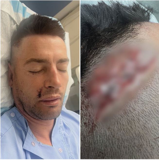 Father-of-two Andreas Lehr was attacked by a stranger after singer Luke Combs' concert outside RAC Arena on Saturday night.
