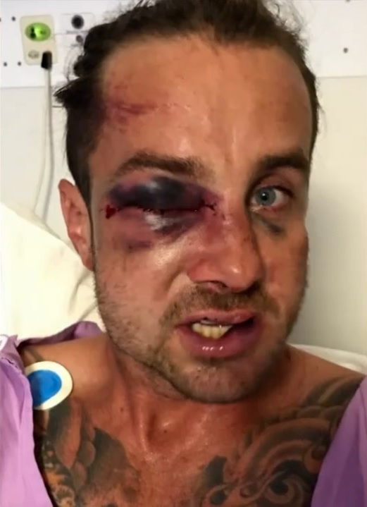 Father claims son 'rounded up by wolves' in football fight