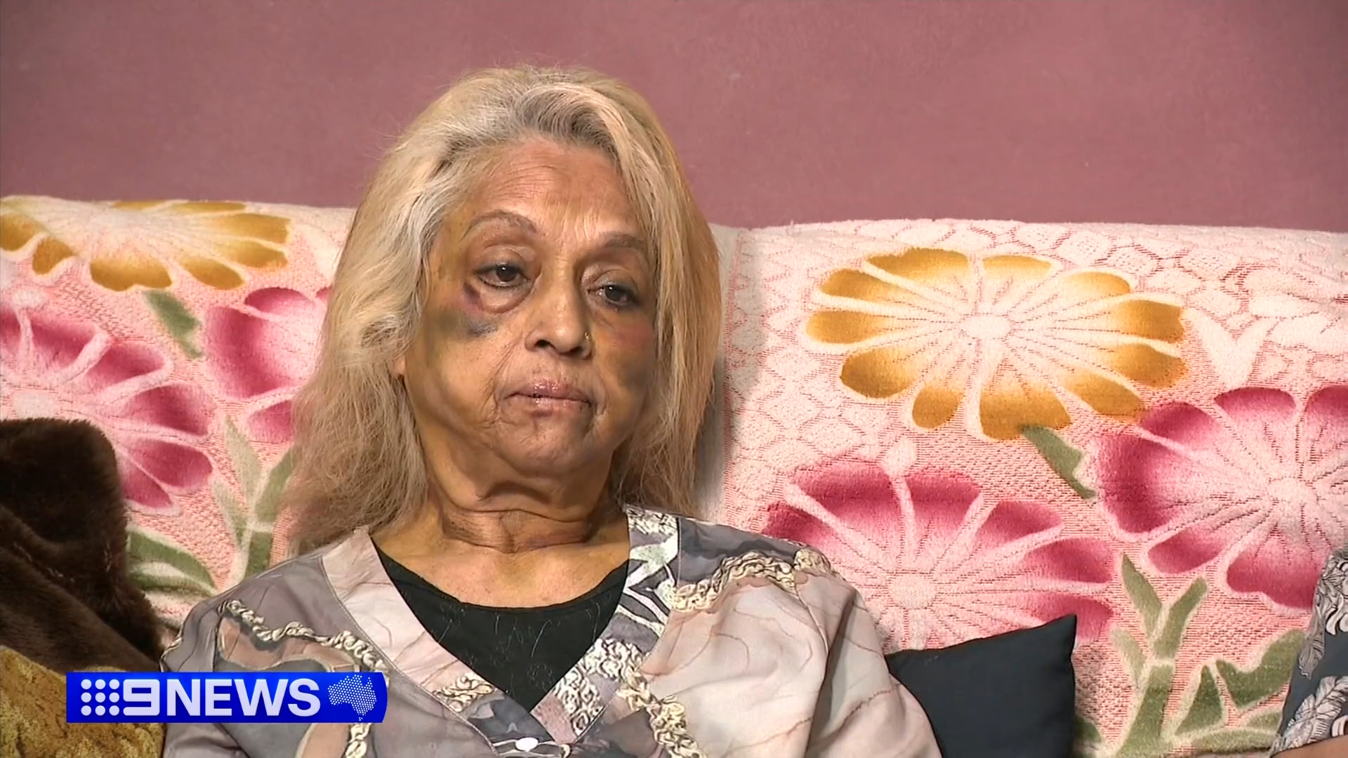 Ninette Simons is still bruised but is bravely sharing her story and pleading for help in finding her attackers, with the three men behind the incident still at large.