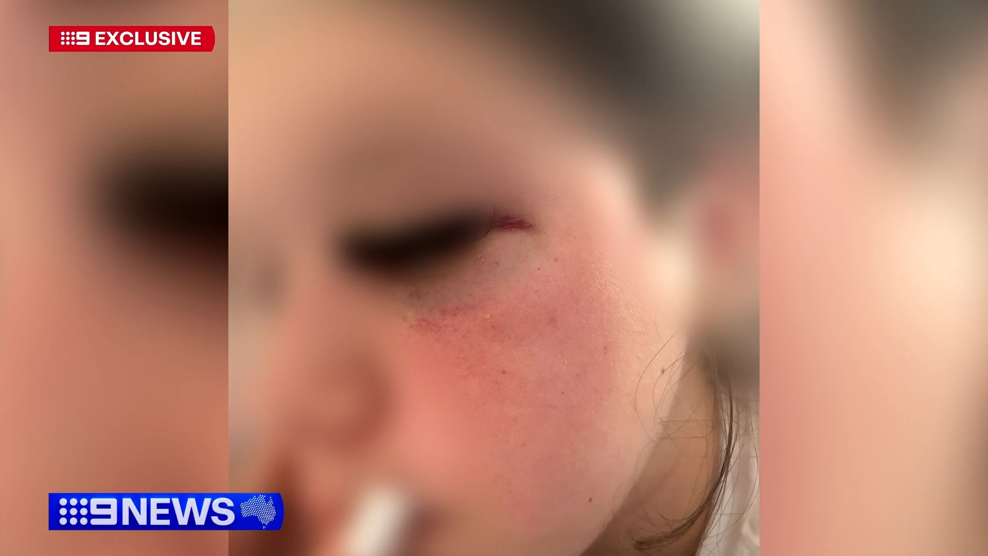 Girl attacked at Shellharbour shopping centre