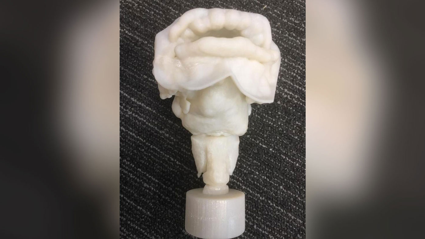 3-D printed vocal tract of Nesyamun.