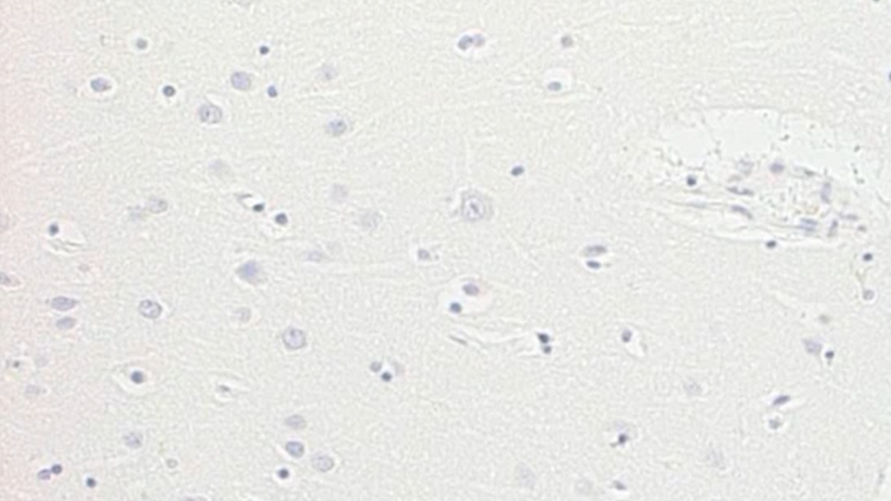 A healthy brain. The expert who studied Paul Green's brain after his death has revealed he suffered crippling CTEs.