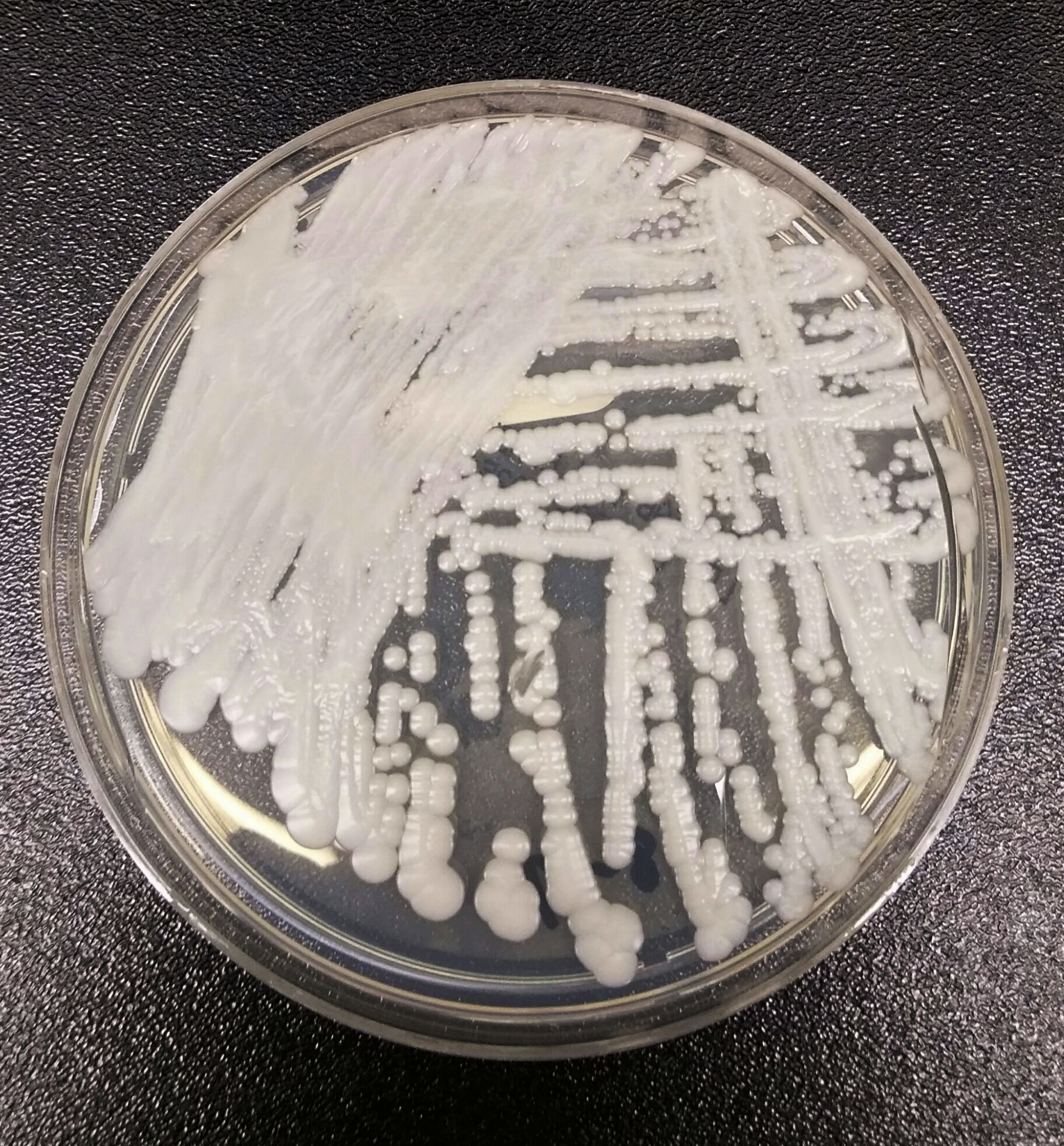 Esta foto sin fecha puesta a disposición por los Centros para el Control y la Prevención de Enfermedades muestra una cepa de Candida auris cultivada en una placa de Petri en un laboratorio de los CDC.