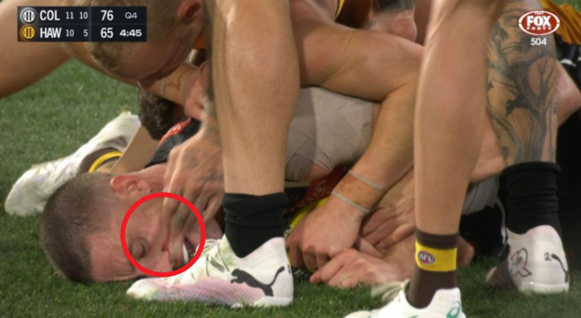 De Goey was caught wiping blood from Cameron's face.