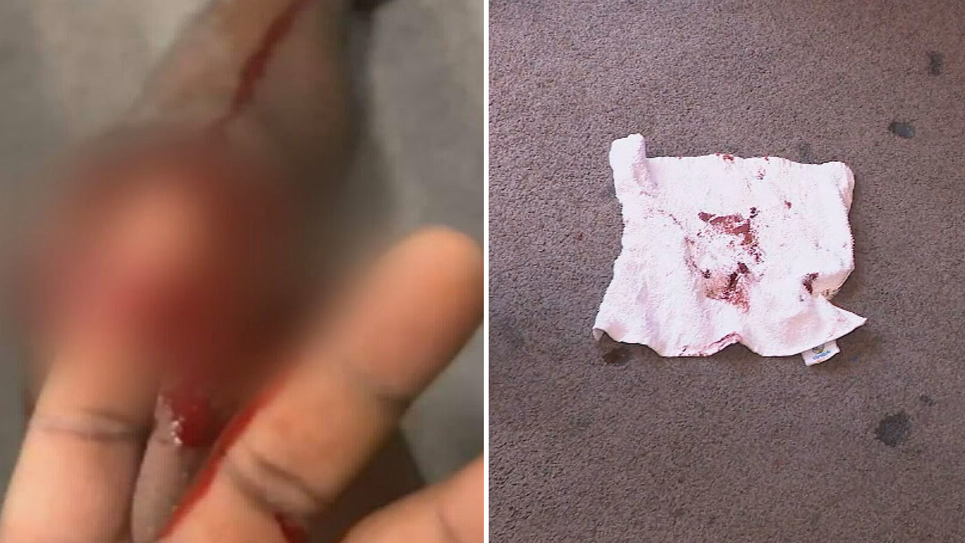 The father was stabbed multiple times and was taken to hospital. Logan stabbing youth crime Queensland Steve Ngabunga 