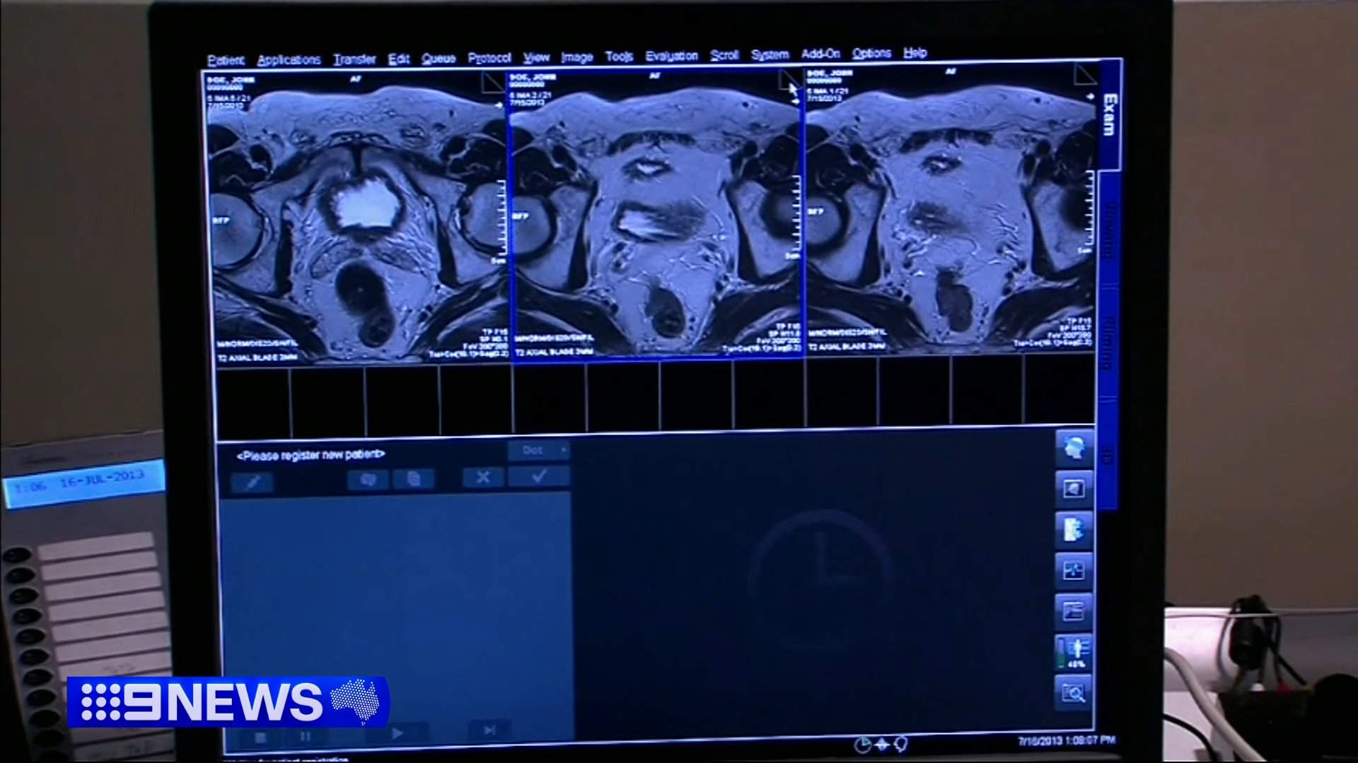 More men will be tested for prostate cancer as part of world-first reforms to boost early detection.