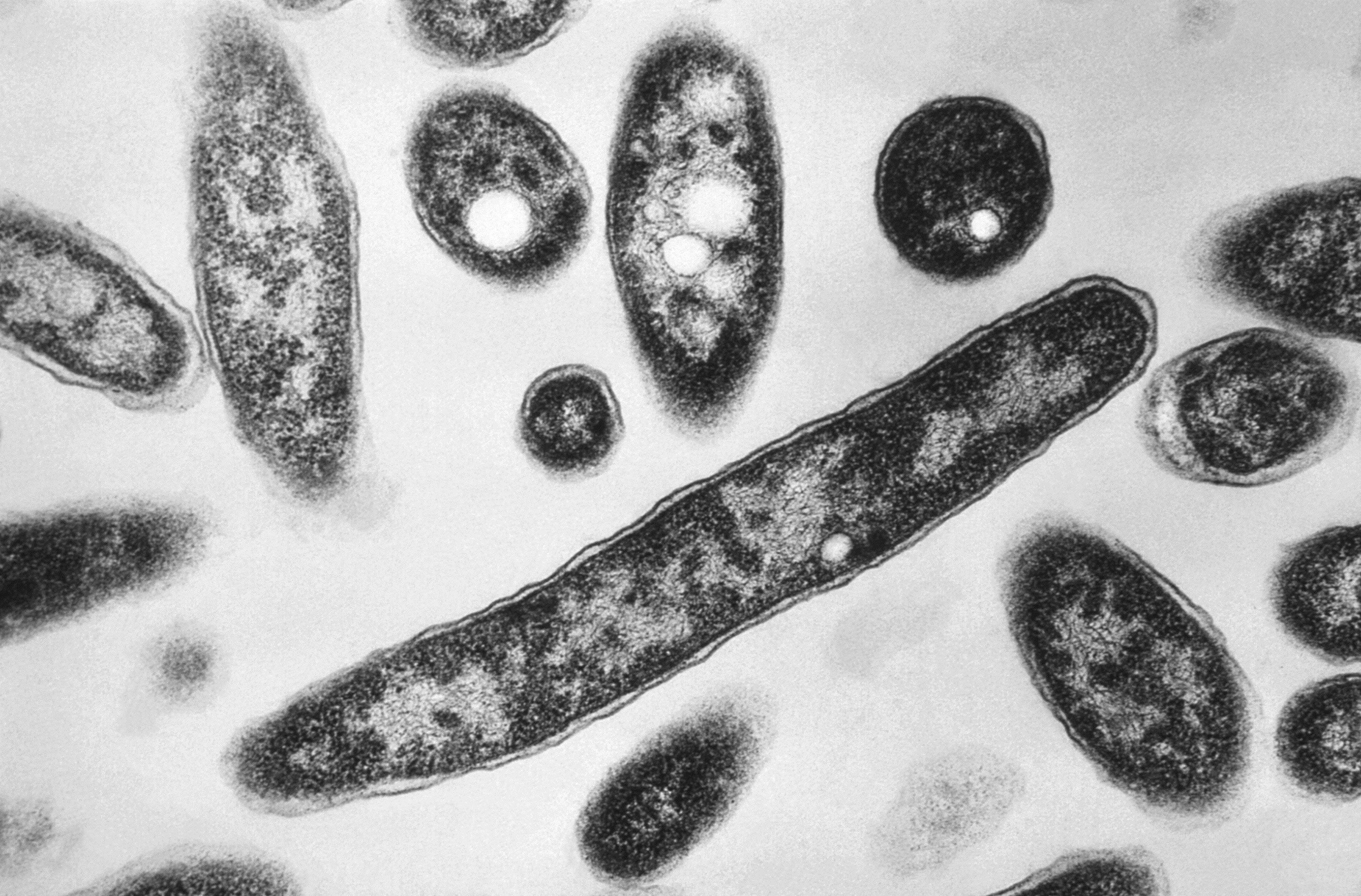 Legionnaires' disease
