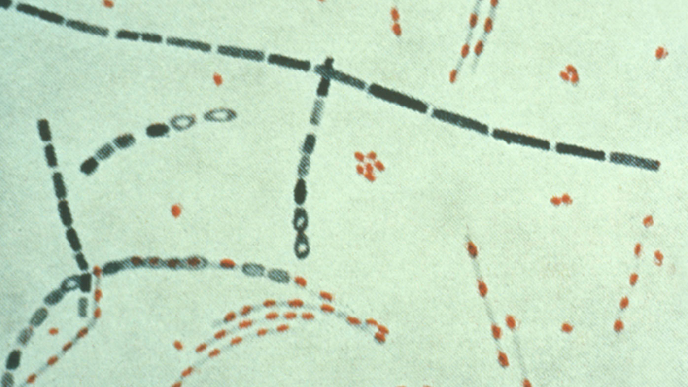 The 1979 Sverdlovsk Anthrax Leak and the Truth About Bioweapons Coverups