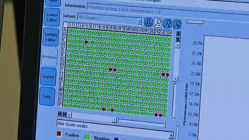The process alone can take up to 12 hours and delivers a simple dot chart for staff to identify cases – red being positive and green being negative. 