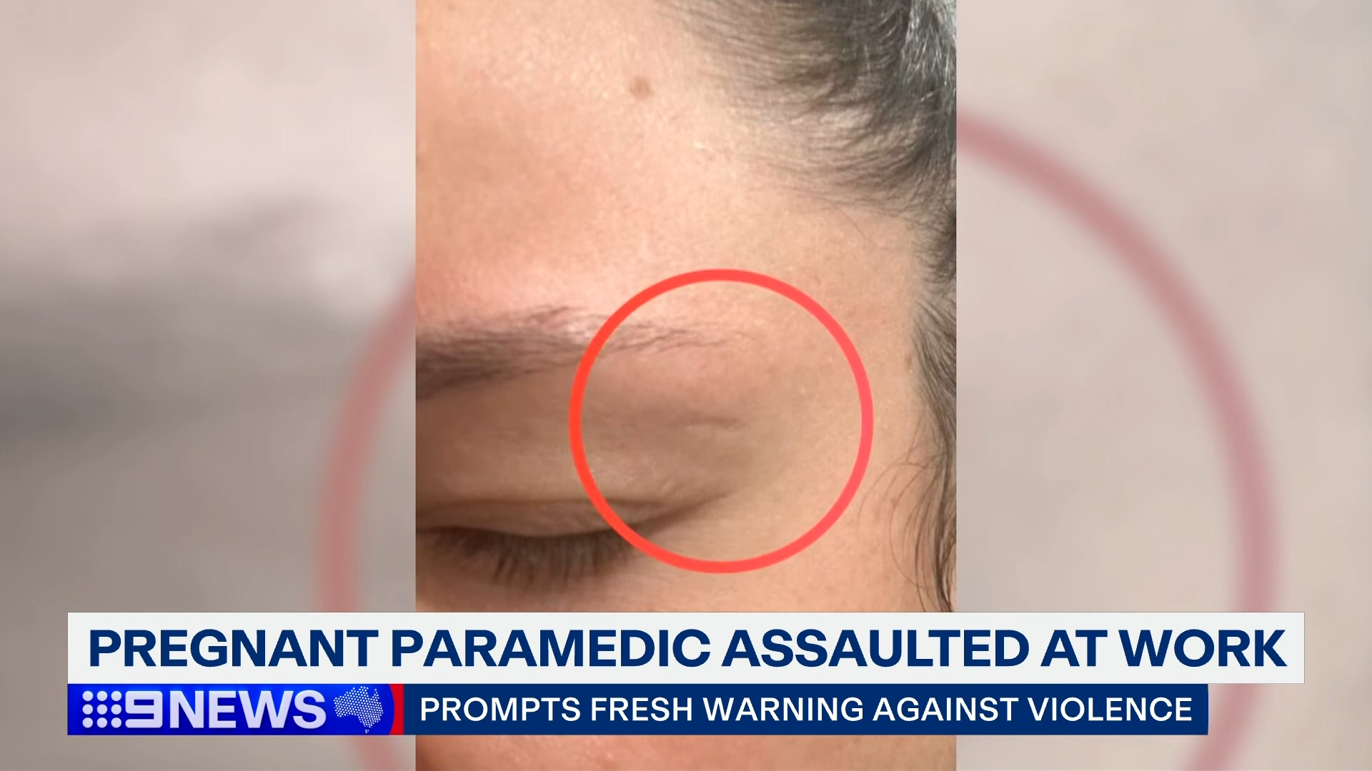 The pregnant paramedic was punched in the face and stomach.