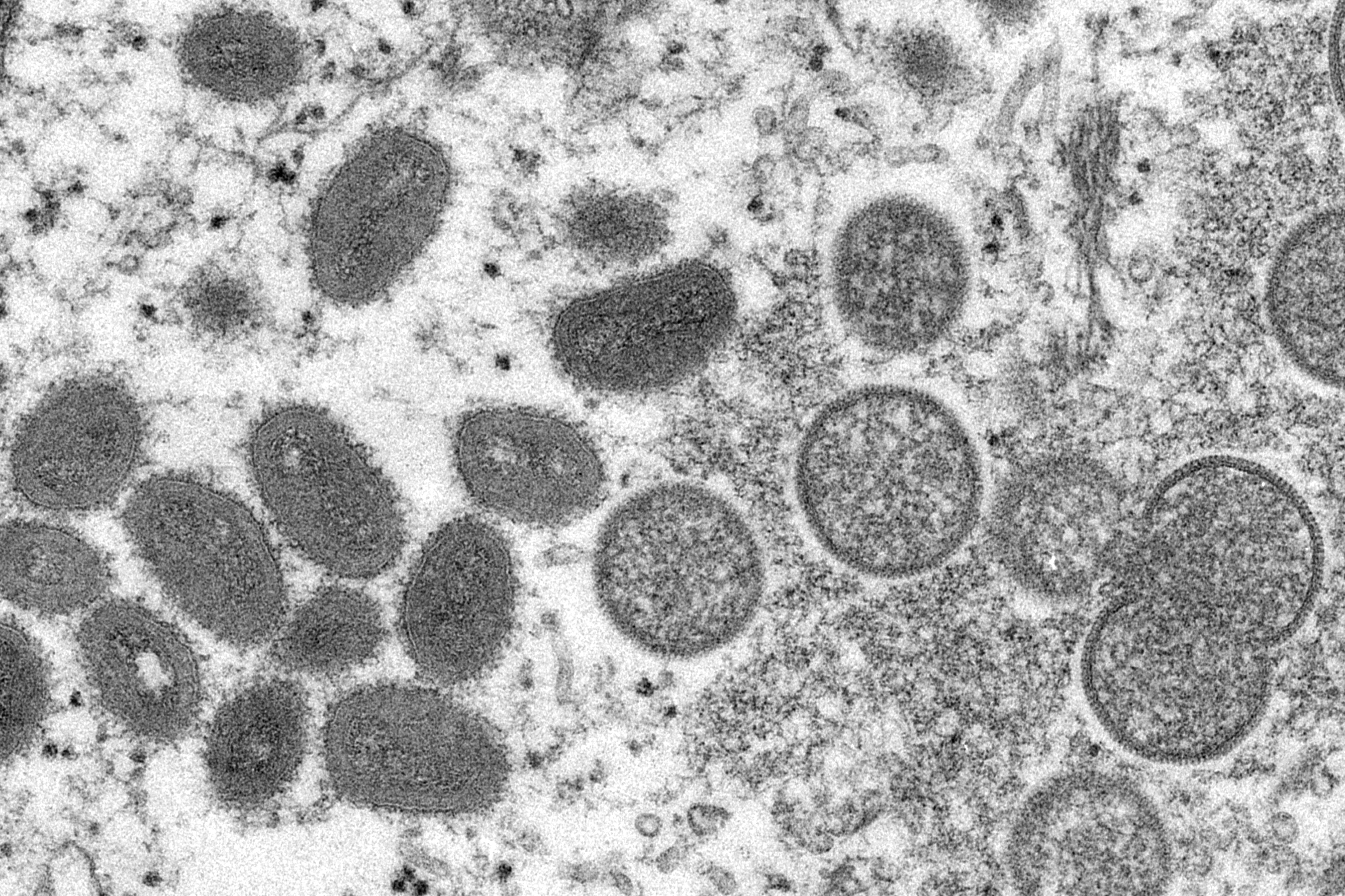 This electron microscopic (EM) image depicted a monkeypox virion, obtained from a clinical sample associated with the 2003 prairie dog outbreak. It was a thin section image from of a human skin sample. On the left were mature, oval-shaped virus particles, and on the right were the crescents, and spherical particles of immature virions. High Resolution: Click here for hi-resolution image (5.21 MB) Content Providers(s): CDC/ Cynthia S. Goldsmith Creation Date: 2003 Photo Credit: Cynthia S. Goldsmi