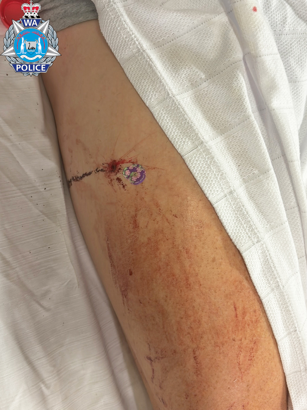 WA Police released some images showing the extent of the man's injuries.