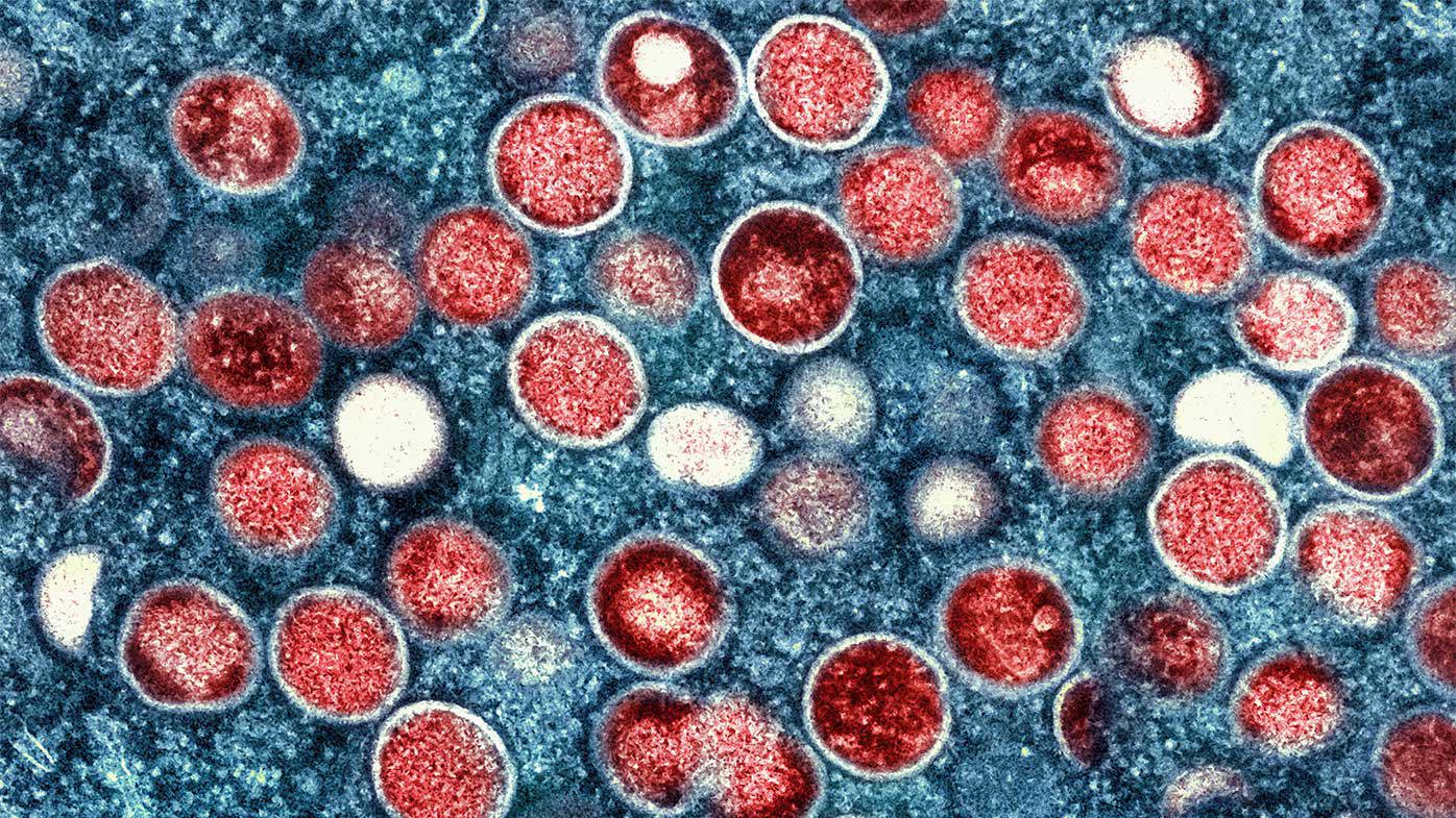 Mpox particles seen in an infected cell.