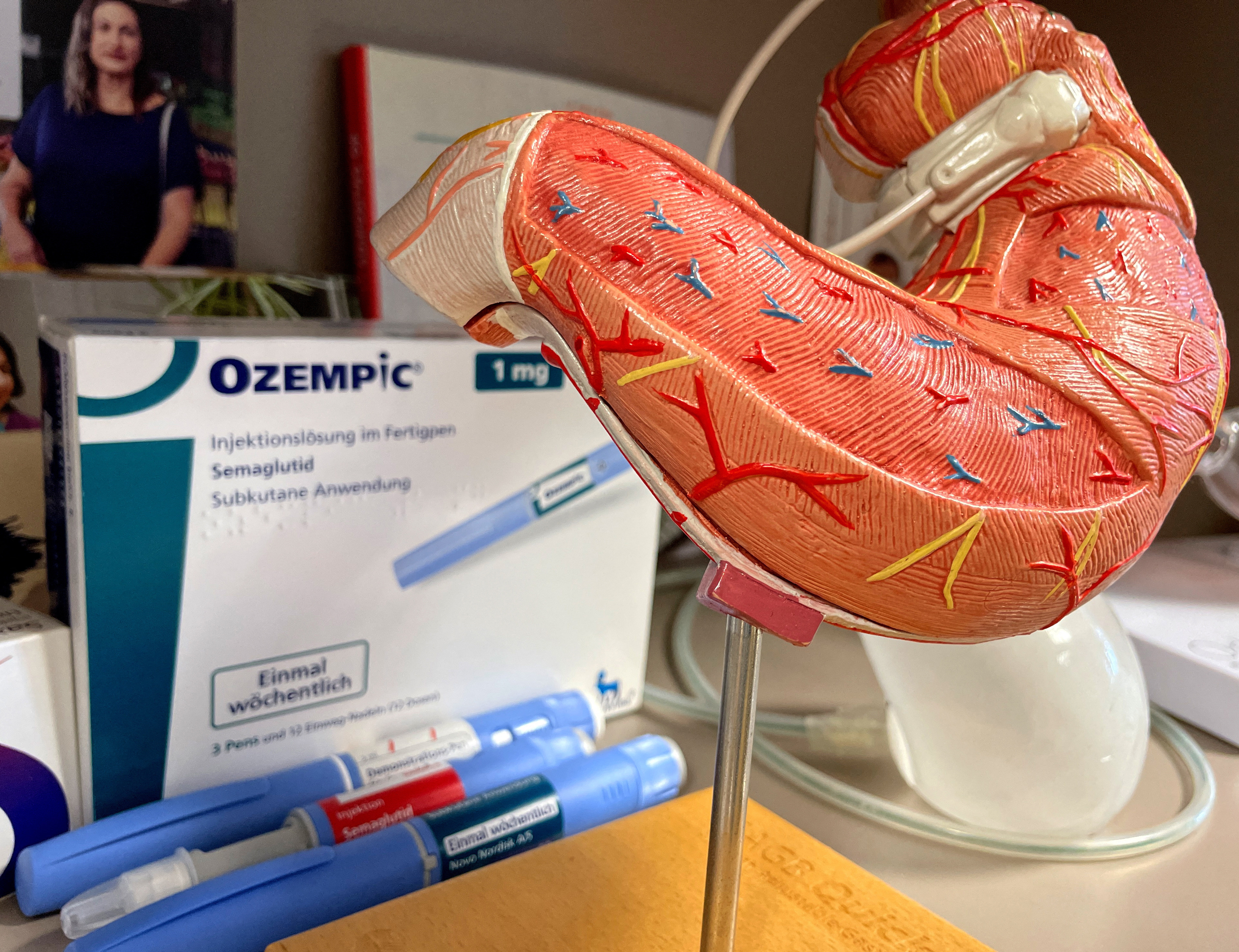 A view of a plastic model of a stomach and some Ozempic packaging