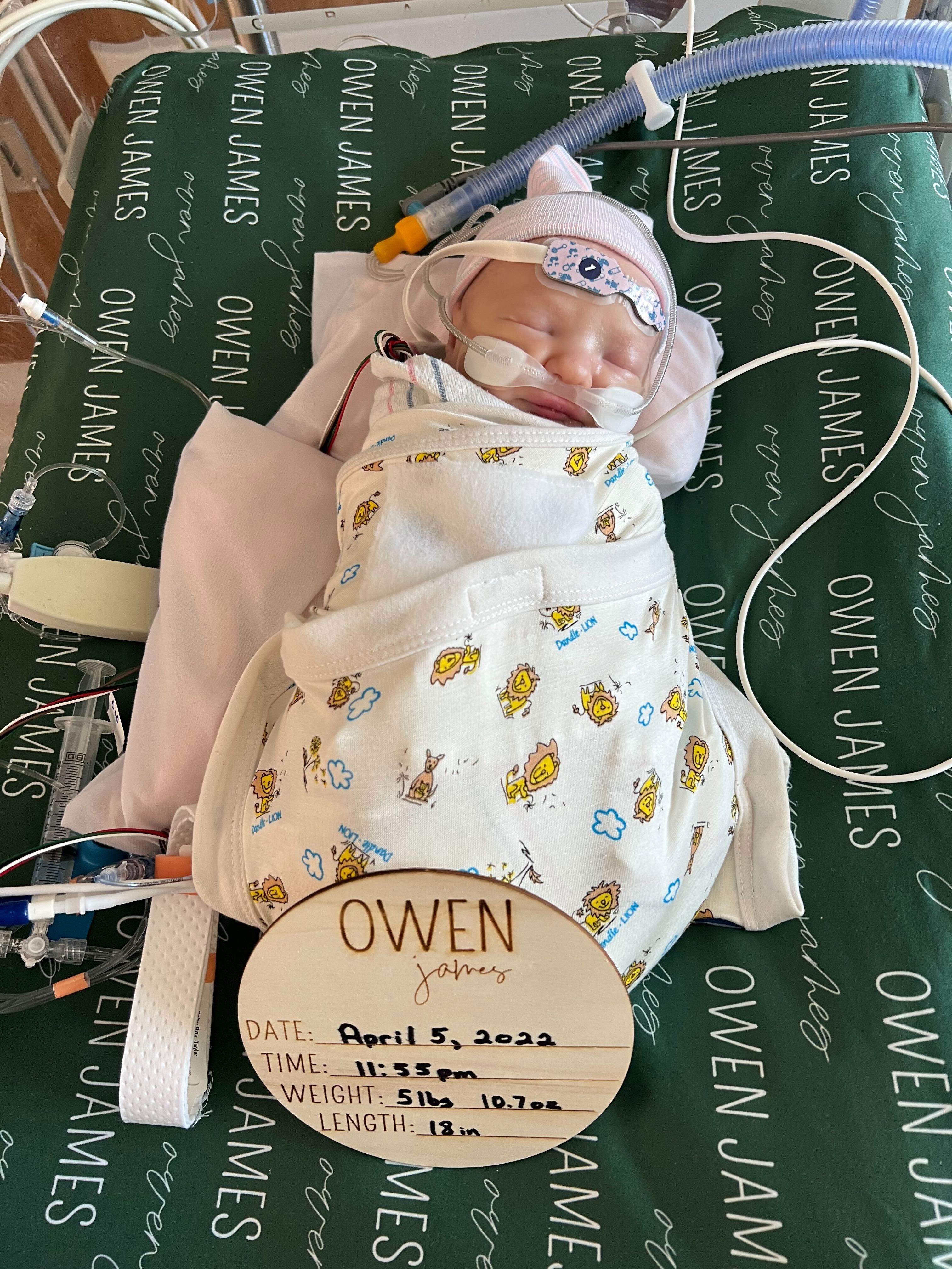 El corazón trasplantado del bebé Owen crece con él por primera vez en el mundo