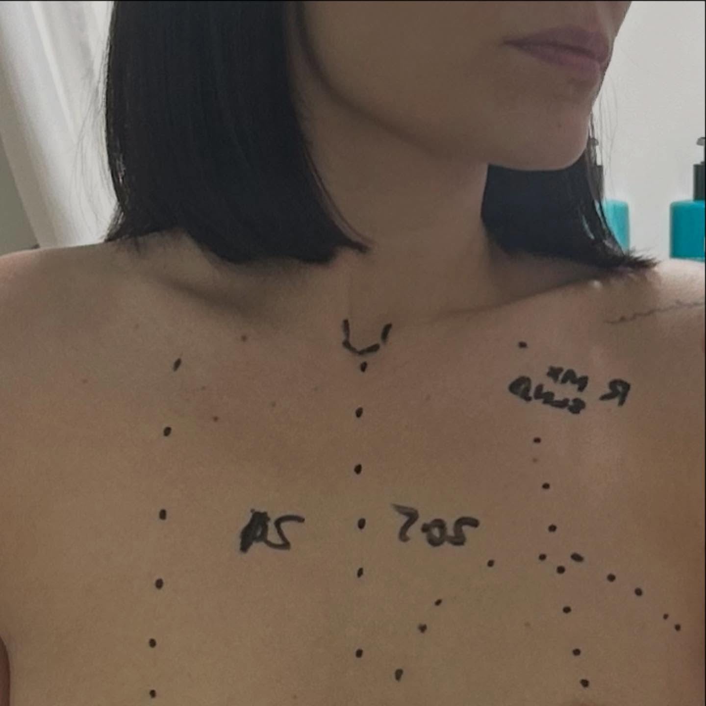 Jessie J at the hospital whilst undergoing breast cancer treatment