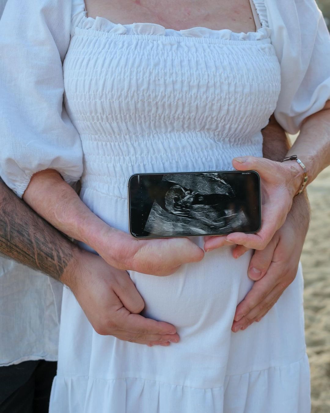 Sophie Delezio reveals she is expecting her first child: 'Greatest gift of all'