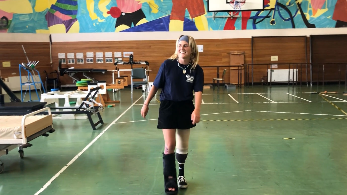Anna Parsons ya vuelve a caminar con su nueva prótesis.