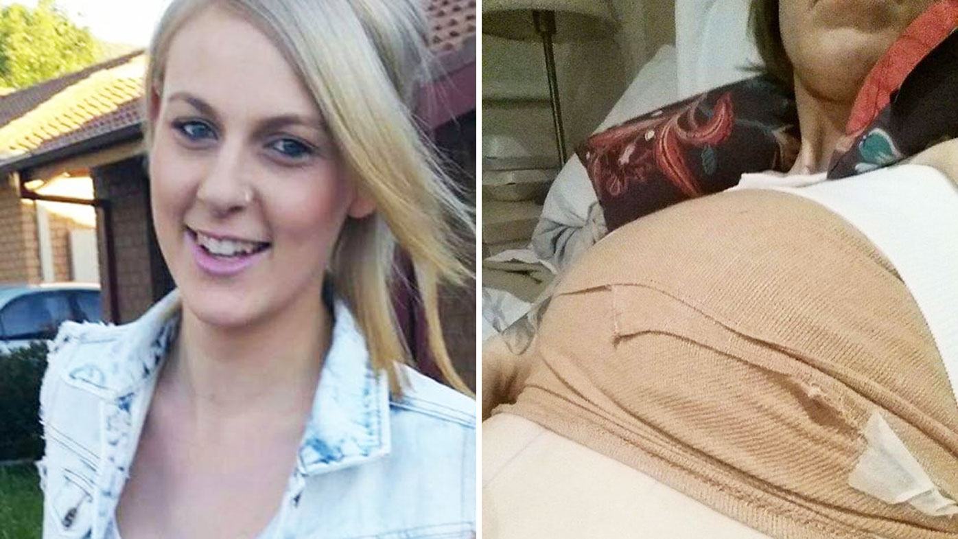 Staple Vie Hurtig News Health: Canberra woman speaks out after botched breast implant surgery