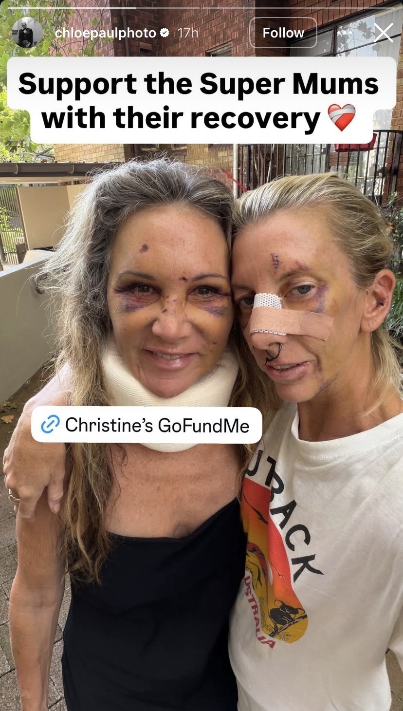 Instagram story showing Potts Point attack victimsChristine Campeau (left) and Chloe Paul.