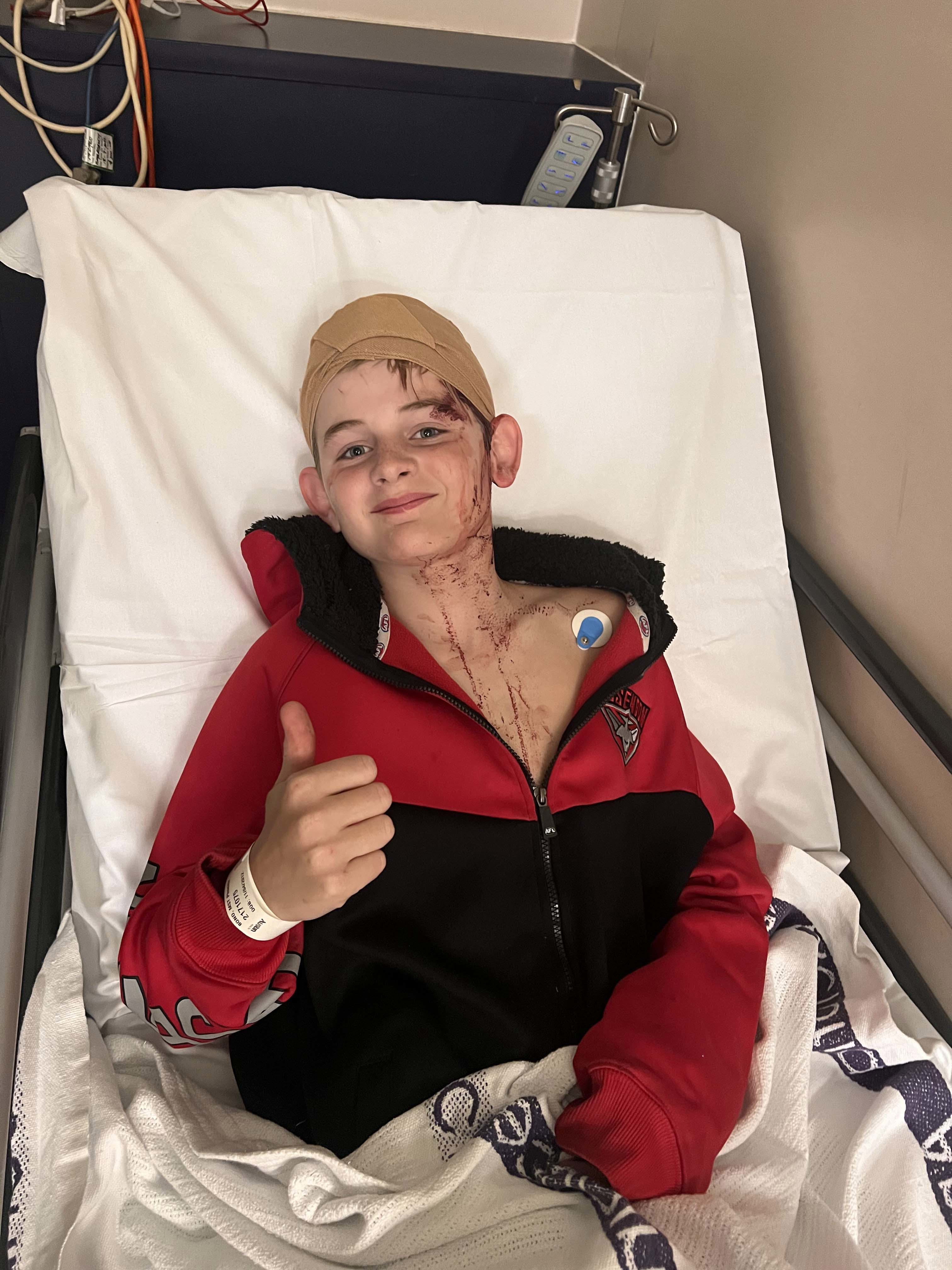 Phoenix, 12, was attacked by a big male kangaroo at home in Victoria.