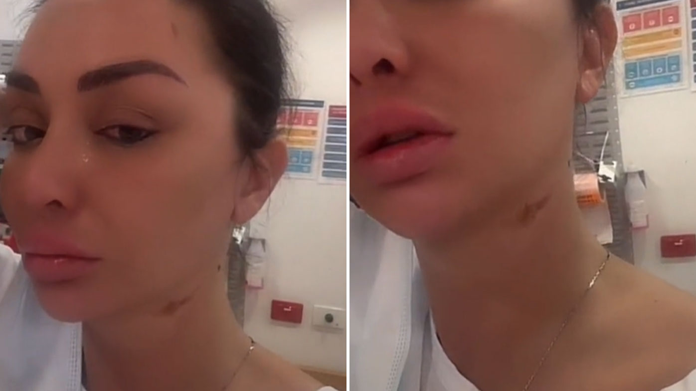 Jenny Elhassan had acid thrown in her face while she was standing on a Sydney street.
