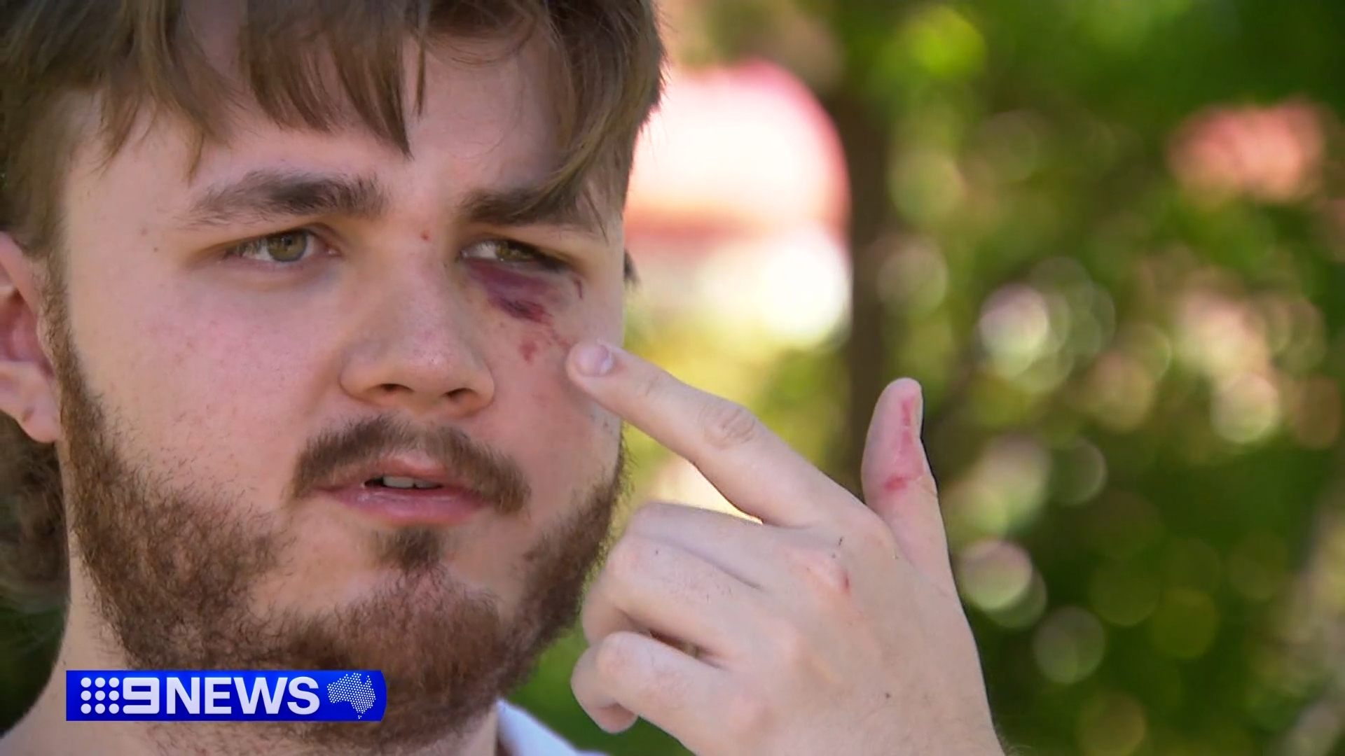 Jarrett said he was shocked at how the quickly the encounter turned violent.